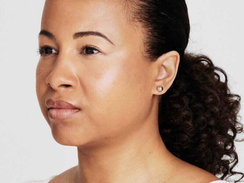 Before-and-after side view showing facial lifting and jawline definition with Ultherapy® non-invasive ultrasound treatment